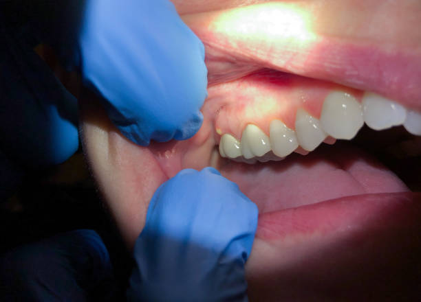 Best Emergency Dental Services for Seniors in Moriches, NY