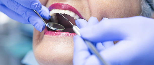 Best Emergency Dentist for Lost Fillings or Crowns in Moriches, NY
